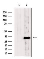 FHL2 Antibody in Western Blot (WB)