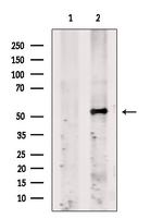 Fibromodulin Antibody in Western Blot (WB)