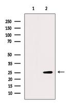 FKBP3 Antibody in Western Blot (WB)