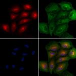 SEM1 isoform 2 Antibody in Immunocytochemistry (ICC/IF)