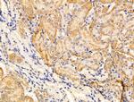 SEM1 isoform 2 Antibody in Immunohistochemistry (Paraffin) (IHC (P))