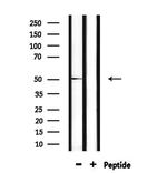 FOXA1 Antibody in Western Blot (WB)