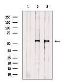 FOXF1 Antibody in Western Blot (WB)