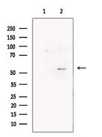 FOXG1 Antibody in Western Blot (WB)