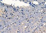 Fascin Antibody in Immunohistochemistry (Paraffin) (IHC (P))