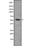 Fascin Antibody in Western Blot (WB)