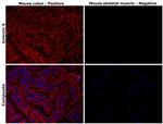 Galectin 9 Antibody in Immunohistochemistry (Paraffin) (IHC (P))