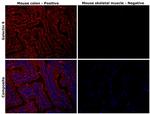 Galectin 9 Antibody