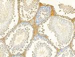 Galectin 9 Antibody in Immunohistochemistry (Paraffin) (IHC (P))