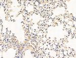 Bombesin Antibody in Immunohistochemistry (Paraffin) (IHC (P))