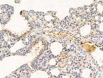 Bombesin Antibody in Immunohistochemistry (Paraffin) (IHC (P))