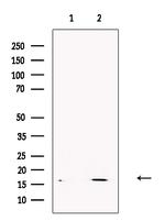 Bombesin Antibody in Western Blot (WB)