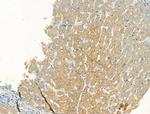 MSTN Antibody in Immunohistochemistry (Paraffin) (IHC (P))