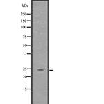 GDNF Antibody in Western Blot (WB)