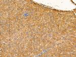 GLS2 Antibody in Immunohistochemistry (Paraffin) (IHC (P))