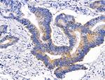 GLUT5 Antibody in Immunohistochemistry (Paraffin) (IHC (P))