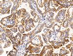 GLUT5 Antibody in Immunohistochemistry (Paraffin) (IHC (P))