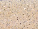 GLUT5 Antibody in Immunohistochemistry (Paraffin) (IHC (P))