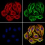 Glutaminase Antibody in Immunocytochemistry (ICC/IF)