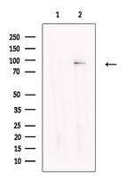 GYS2 Antibody in Western Blot (WB)