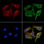 ZDHC3 Antibody in Immunocytochemistry (ICC/IF)