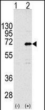 CNOT4 Antibody in Western Blot (WB)