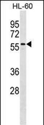 CNOT4 Antibody in Western Blot (WB)