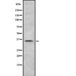 A33 Antibody in Western Blot (WB)