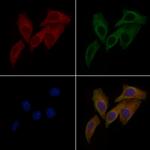 TEM5 Antibody in Immunocytochemistry (ICC/IF)