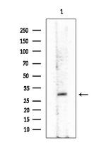 GPR40 Antibody in Western Blot (WB)