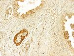 GZMB/GZMH Antibody in Immunohistochemistry (Paraffin) (IHC (P))