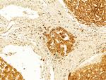 GZMB/GZMH Antibody in Immunohistochemistry (Paraffin) (IHC (P))