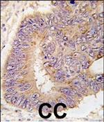 PDE8A Antibody in Immunohistochemistry (Paraffin) (IHC (P))