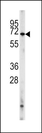 PDE8A Antibody in Western Blot (WB)