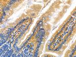 GSTT1 Antibody in Immunohistochemistry (Paraffin) (IHC (P))