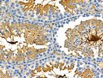 GSTT1 Antibody in Immunohistochemistry (Paraffin) (IHC (P))