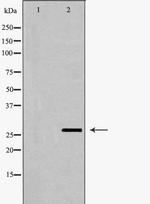 GSTT1 Antibody in Western Blot (WB)