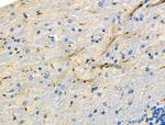 HAPLN1 Antibody in Immunohistochemistry (Paraffin) (IHC (P))