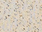 HAPLN1 Antibody in Immunohistochemistry (Paraffin) (IHC (P))