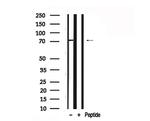 HCLS1 Antibody in Western Blot (WB)