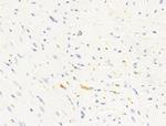 HHIP Antibody in Immunohistochemistry (Paraffin) (IHC (P))