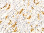 HHIP Antibody in Immunohistochemistry (Paraffin) (IHC (P))