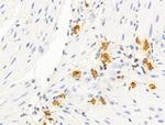 HHIP Antibody in Immunohistochemistry (Paraffin) (IHC (P))