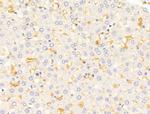 HHIP Antibody in Immunohistochemistry (Paraffin) (IHC (P))