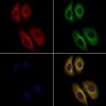 HIBADH Antibody in Immunocytochemistry (ICC/IF)