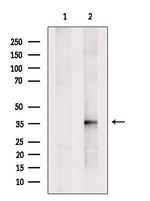 HIBADH Antibody in Western Blot (WB)