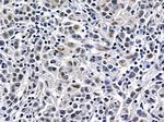 HIPK1 Antibody in Immunohistochemistry (Paraffin) (IHC (P))