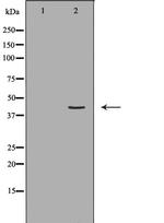 HLA-ABC Antibody in Western Blot (WB)