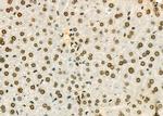 PCBP1 Antibody in Immunohistochemistry (Paraffin) (IHC (P))