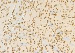 PCBP1 Antibody in Immunohistochemistry (Paraffin) (IHC (P))